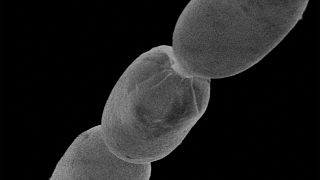 أكبر بكتيريا في العالم.
