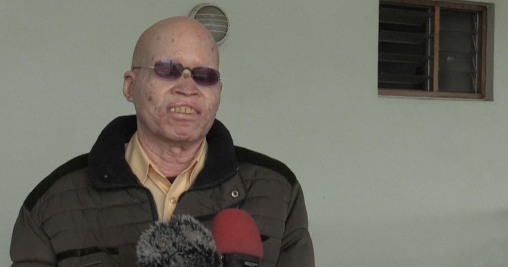 Malawi court sentences 12 for murder and transacting human tissue of man with albinism