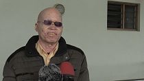 Malawi court sentences 12 for murder and transacting human tissue of man with albinism