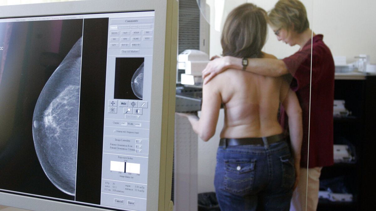 Mammográfiát végeznek egy nőnél 2007 áprilisában