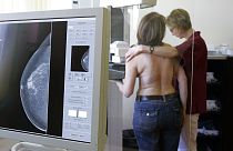 Mammográfiát végeznek egy nőnél 2007 áprilisában