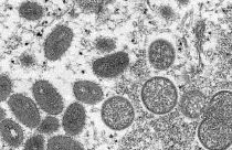 This 2003 electron microscope image from the Centers for Disease Control and Prevention shows mature, oval-shaped monkeypox virions, left, and spherical immature, right.