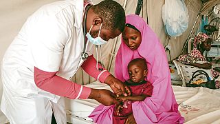 Nigeria's troubled northwest battles child malnutrition