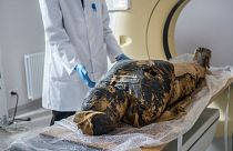 مومیایی باردار مصری و تصویربرداری با اشعه ایکس در یک مرکز پزشکی در لهستان