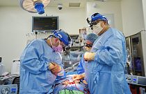 Medicos de NYU Langone Health trabajan con un corazón de cerdo modificado genéticamente en una persona fallecida.