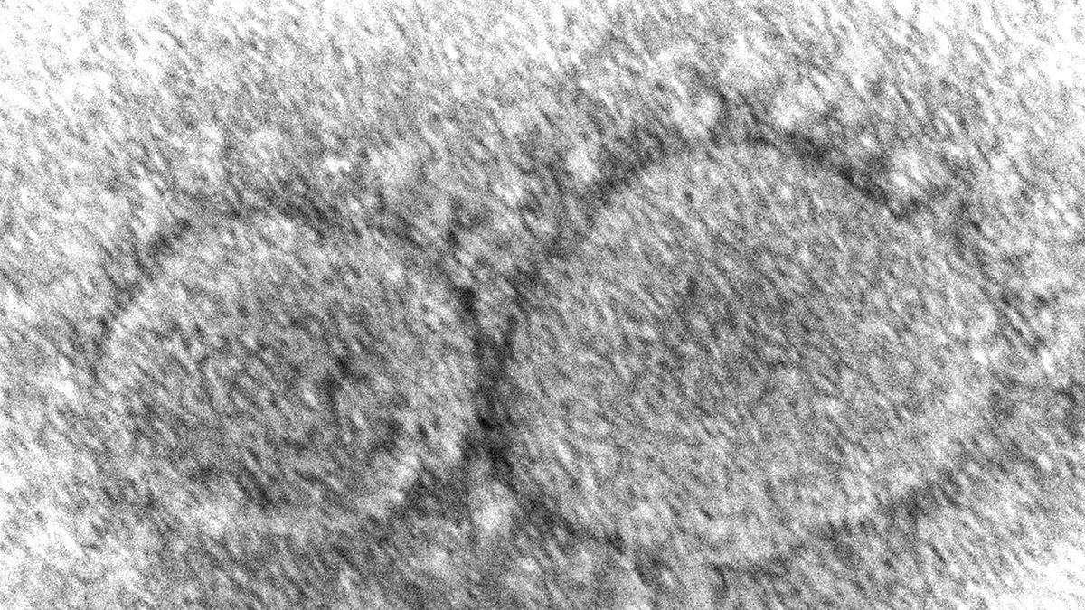 Esta imagen muestra las partículas del virus SARS-CoV-2. Específicamente la mutación del coronavirus que pertenece a la familia ómicron. 