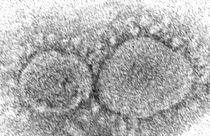 Esta imagen muestra las partículas del virus SARS-CoV-2. Específicamente la mutación del coronavirus que pertenece a la familia ómicron.