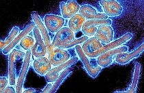 A micrograph of the highly contagious and deadly Marburg virus