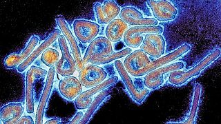 A micrograph of the highly contagious and deadly Marburg virus