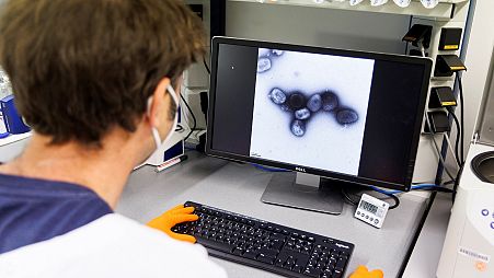 An employee of the vaccine company Bavarian Nordic shows a picture of a vaccine virus on a display in a laboratory of the company in Martinsried near Munich, Germany.