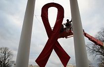 HIV virüsü taşıyan bir kişinin daha AIDS'i yendiği açıklandı