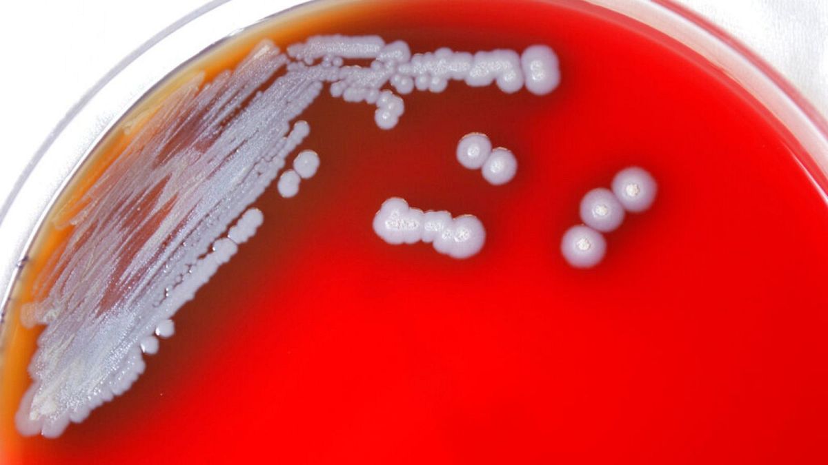 تصویری که مرکز پیشگیری و مقابله با بیماری‌ها در آمریکا از کلونی‌های باکتری عامل بیماری ملیویدوسیس منتشر کرده است