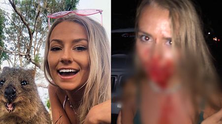 Jordan Katherine endured every traveller's worst nightmare while on holiday earlier this year