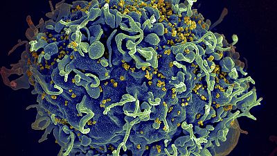 The UN has raised the alarm over efforts to prevent new HIV infections stalling during the pandemic.