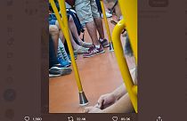 Mann mit Affenpocken in der Metro in Madrid