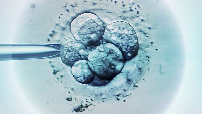 The mouse's synthetic embryos grew for eight days outside of a womb. The mouse's synthetic embryos grew for eight days outside of a womb.