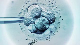 Fare kök hücresinden oluşturulan sentetik embriyo