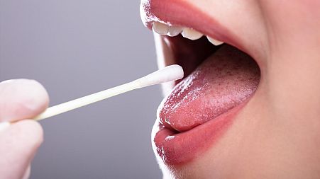 Oral and throat cancers are notoriously difficult to detect – but a new saliva test, launched in the US, could change the game and enable much earlier diagnosis for patients. 