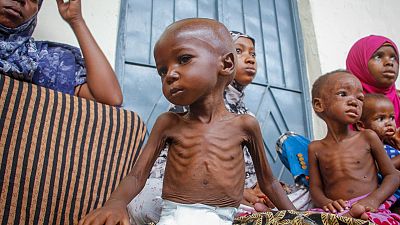 طفل يعاني من سوء التغذية يجلس بجوار والدته التي نزحت مؤخرًا بسبب الجفاف في مقديشو، الصومال