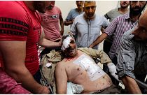 جريح بأحد المستشفيات إثر قصف لقوات النظام على سوق مزدحم في مدينة الباب الخاضعة لسيطرة المعارضة