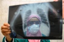 طبيبة مصرية تفحص أشعة سينية لرئة مريض في وحدة الأمراض المعدية بمستشفى إمبابة بالعاصمة القاهرة، مصر، في 19 أبريل 2020