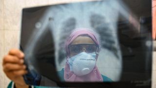 طبيبة مصرية تفحص أشعة سينية لرئة مريض في وحدة الأمراض المعدية بمستشفى إمبابة بالعاصمة القاهرة، مصر، في 19 أبريل 2020