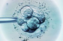 Los embriones de la FIV se congelan cada vez más durante unos meses -o años- antes de descongelarlos e implantarlos para el embarazo.