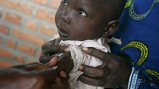 Measles outbreak kills 700 children in Zimbabwe
