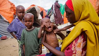 UNICEF'ten yapılan açıklamada, kıtlığın pençesindeki Somali'de ocak ve temmuz ayları arasında ülkedeki beslenme merkezlerinde 730 çocuğun hayatını kaybettiği bildirildi