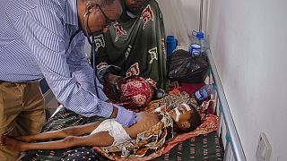 UN: Around 730 children dead In Somalia nutrition centres