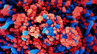 تصویری میکروسکوپی که یک سلول بدن (به رنگ آبی) را درگیر با ویروس کرونا (به رنگ قرمز) نشان می‌دهد