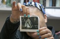 A medical worker shows an ultrasound image of a foetus.