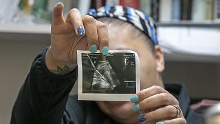 A medical worker shows an ultrasound image of a foetus.