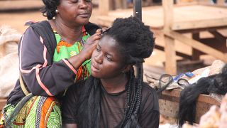 Cameroun : le combat contre la dépigmentation de peau