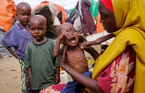 Somalia is facing its worst drought on record, with one million people forced to flee their homes.