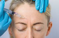 Some scientists think Botox injections could be used as part of treatment for some mental health conditions