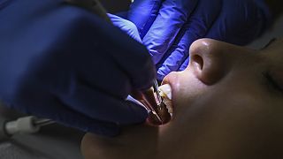 A close-up view of a dentist working on a patient at a dental clinic in Istanbul, 16 September 2022