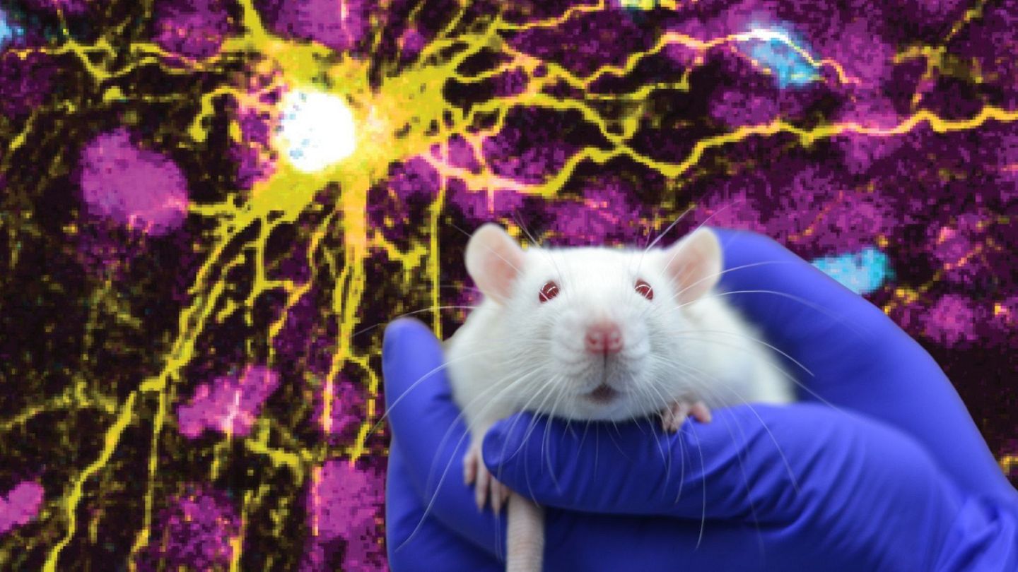 Scientists grow human 'mini brains' in baby rats to study disorders like  autism and schizophrenia | Euronews