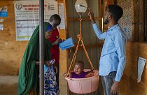 В Сомали 1,8 млн. детей в возрасте до 5 лет могут столкнуться с острым недоеданием в период с июля 2022 года по июнь 2023 года.