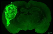 Sıçanların beynine insan beyni benzeri organoid nakledildi