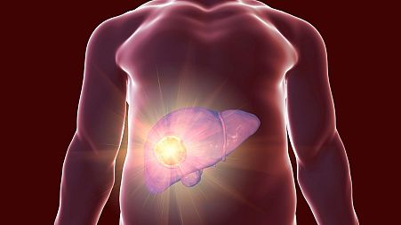 Some transplanted livers can keep going for more than a 100 years.
