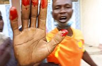 Un manifestant avec la main ensanglantée, à N'Djamena, Tchad, le 20 octobre 2022