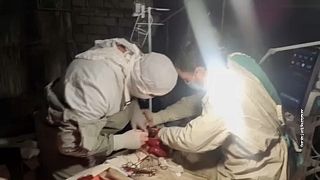 Врачи делают операцию в подвале больницы украинского Изюма