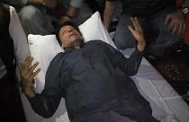 صورة لرئيس الوزراء الباكستاني السابق بعد إصابته بإطلاق نار في وزير أباد، باكستان، الخميس 3 نوفمبر 2022.