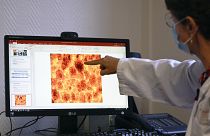 لورانس كيسل ، أستاذة أمراض السكر في مستشفى جامعة ستراسبورغ، تشير إلى صورة مجهرية على الشاشة لجزر البنكرياس. 2022/11/14