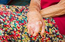 Leprosy can cause disfiguring sores, but the bacteria behind it may actually hold the secret to safely regenerating body tissue, scientists say.