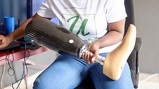 Afrique du Sud : des prothèses low-cost imprimées en 3D