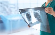 Machine learning is being used to discover new information from X-rays
