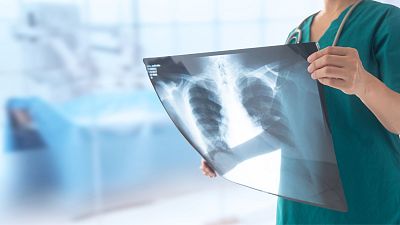 Machine learning is being used to discover new information from X-rays