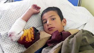A wounded boy receives treatment at a hospital after the deadly bomb blast.